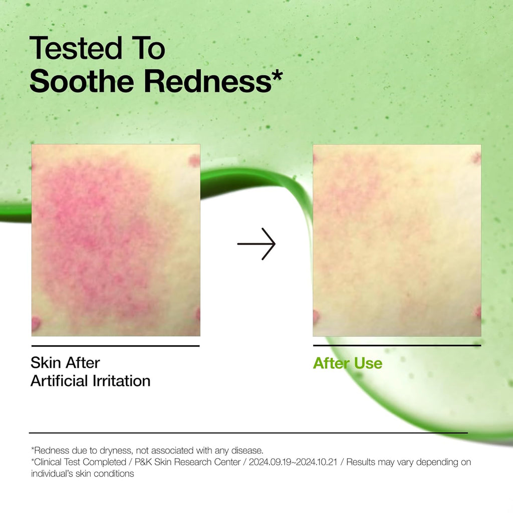 Anua Azelaic Acid 10 Hyaluron Redness Soothing Serum - 30ml Expiry 09 - 2028